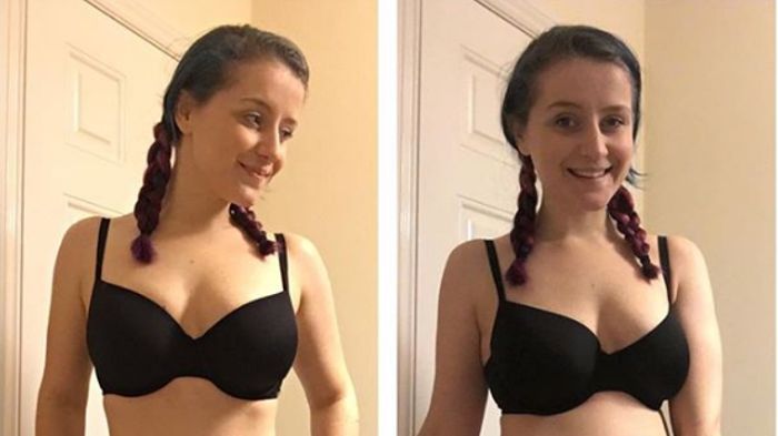 Znana blogerka z dysmorfofobią publikuje zaskakującą metamorfozę. "Nie wierzcie w idealne zdjęcia na Instagramie"