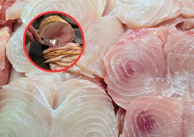 Prosta zmiana. Może ocalić życie nawet 750 tys. osób rocznie