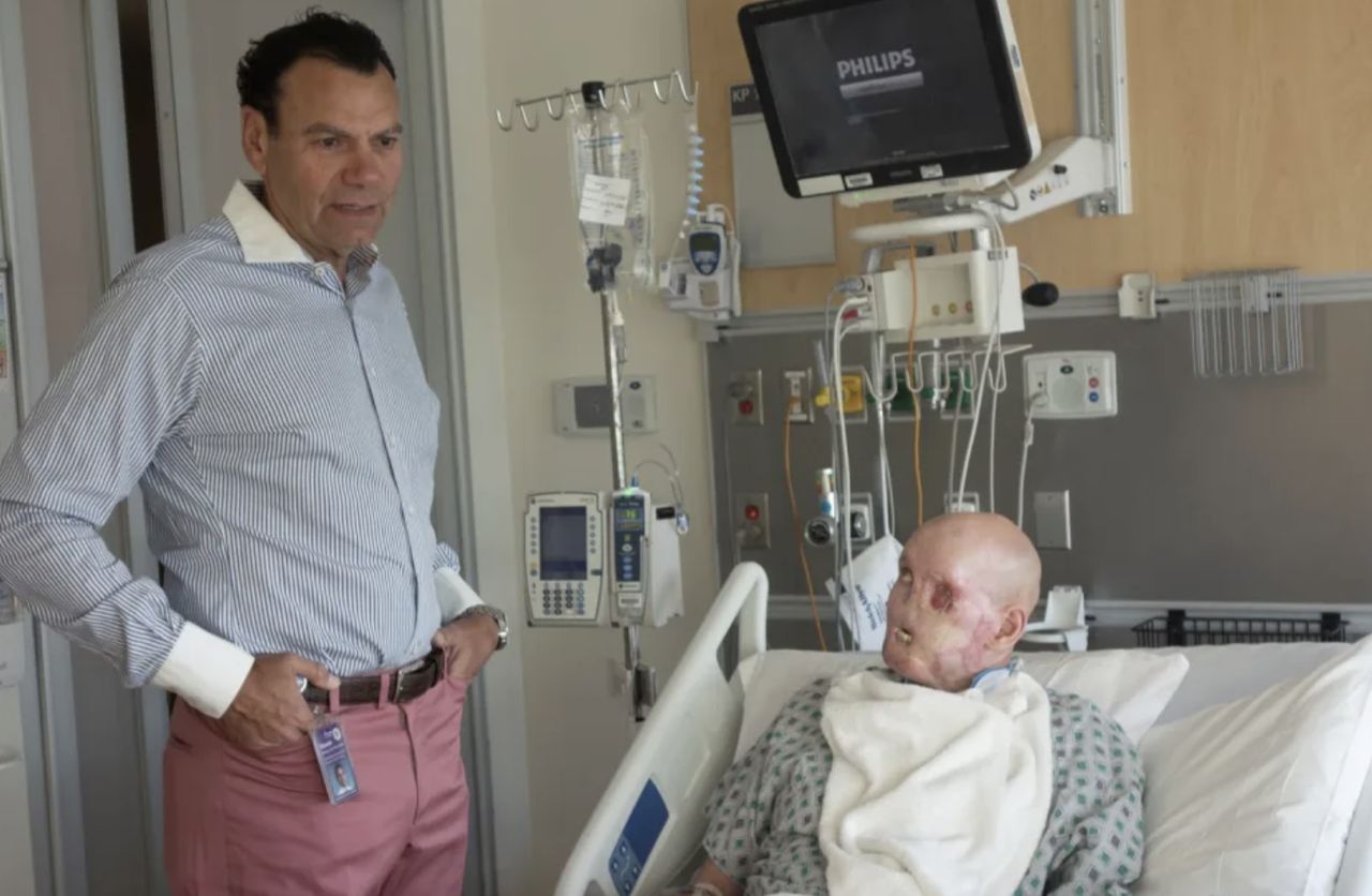 Patient Aaron James and his doctor Eduardo D. Rodriguez before the facial reconstruction in May 2023.