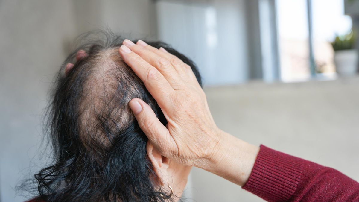 Nowe zastosowanie stewii. Wspomaga działanie leków przeciw łysieniu