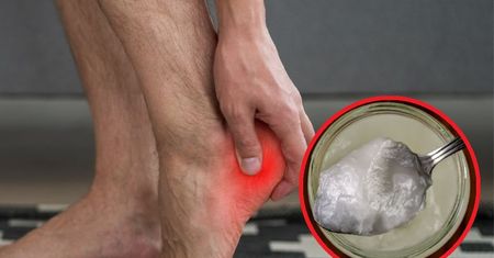 Jak pozbyć się ostrogi piętowej? Wypróbuj naturalną miksturę