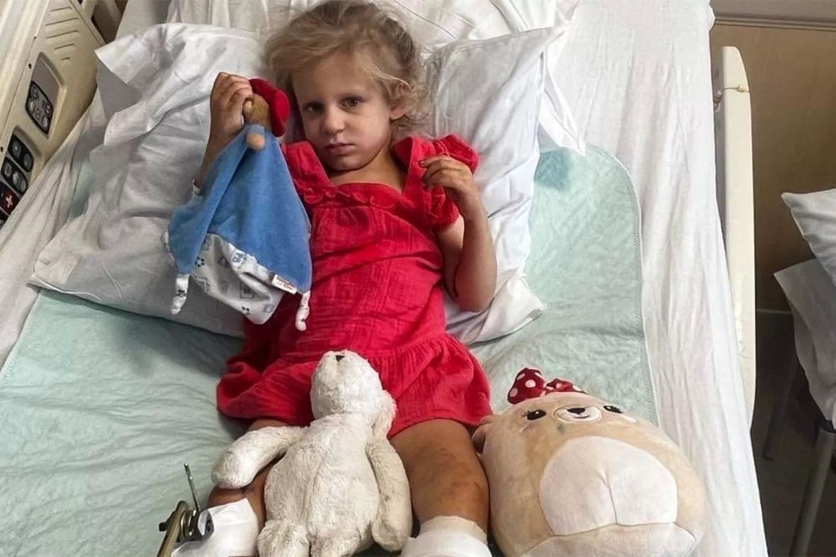 Trzyletnia Isla doznała poważnych obrażeń