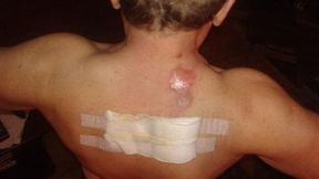 Sprawa kibica poparzonego racą może być bardzo kłopotliwa dla PZPN