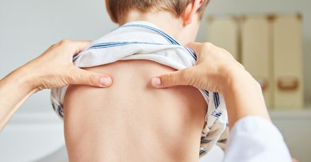 Odstające łopatki – przyczyny i ćwiczenia
