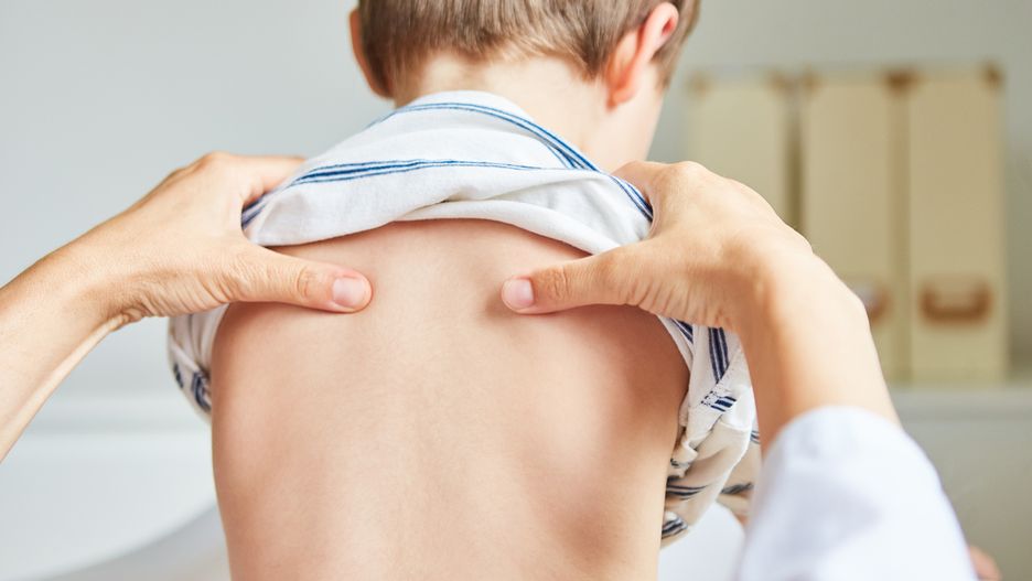 Odstające łopatki – przyczyny i ćwiczenia