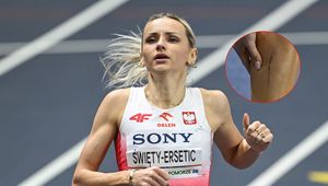 Problem polskiej gwiazdy na HMŚ. Musiał interweniować ratownik medyczny