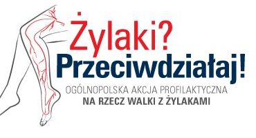 Ruszyła kampania „Żylaki? Przeciwdziałaj!”