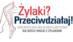 Ruszyła kampania „Żylaki? Przeciwdziałaj!”