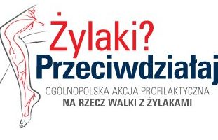 Ruszyła kampania „Żylaki? Przeciwdziałaj!”