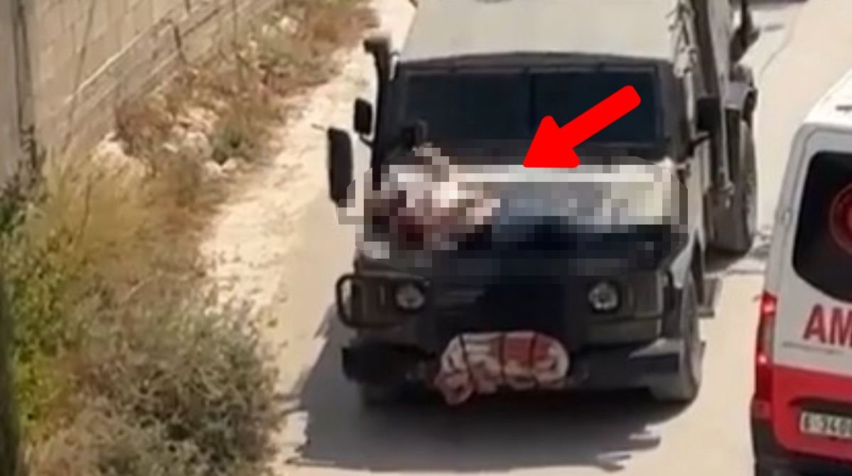 The Israelis tied the wounded man to the jeep.