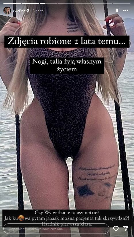 Ewel0na zachwyca się efektami ostatniej operacji plastycznej 