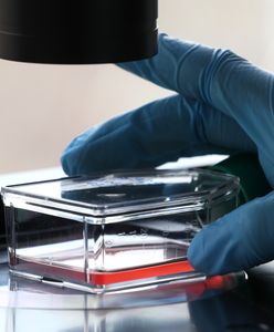 Mutacja Delta. Kolejny chory w Katowicach. Nowe przypadki zakażenia groźnym wariantem indyjskim