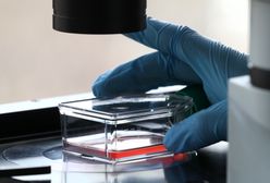 Mutacja Delta. Kolejny chory w Katowicach. Nowe przypadki zakażenia groźnym wariantem indyjskim