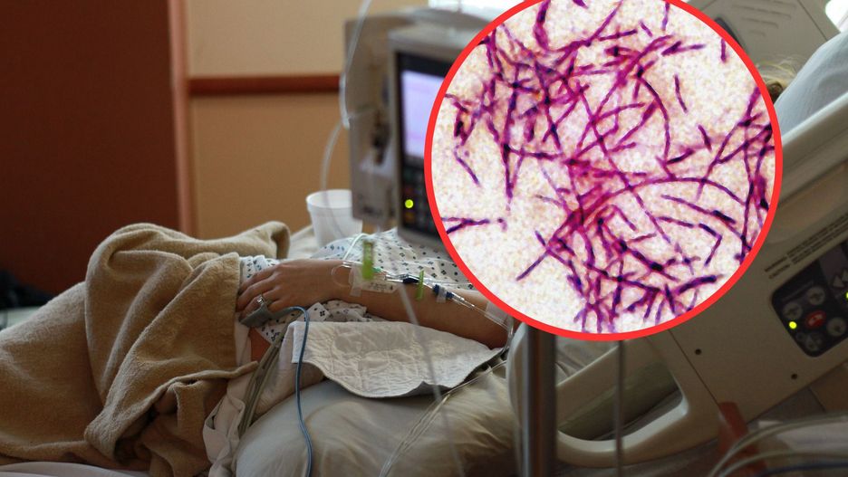Legionella. Objawy, zakażenie, leczenie, śmiertelność