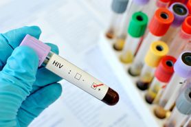Największe mity na temat HIV - obalają eksperci