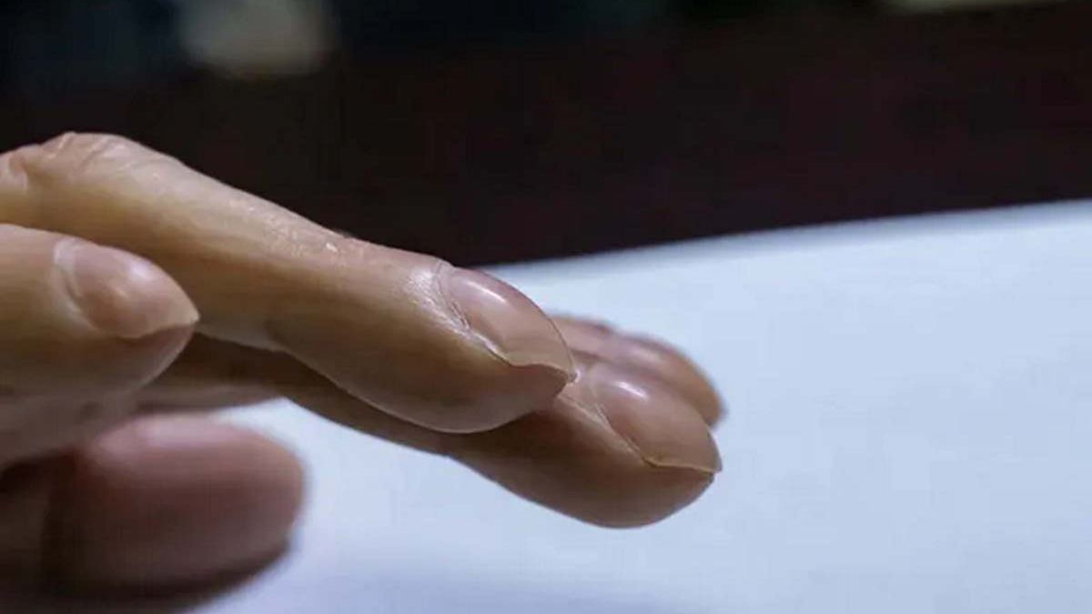 Palce pałeczkowate to groźny objaw