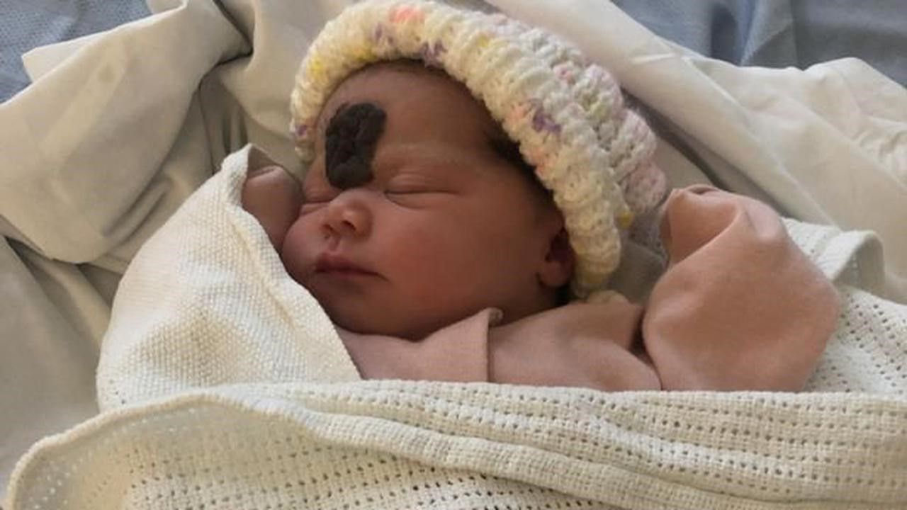 Niemal rok temu na świat przyszła dziewczynka z nietypowym znamieniem