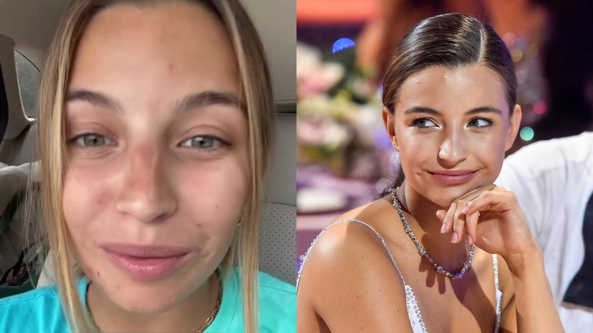 Julia Wieniawa relacjonuje renowację twarzy po wakacjach 