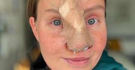 Horror w Szwecji. Pies odgryzł nos swojej właścicielce