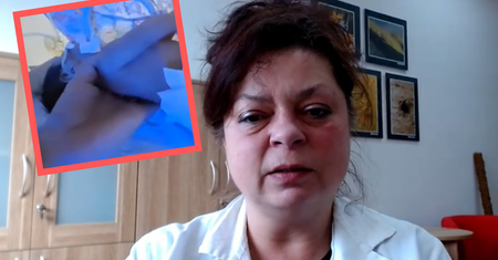 Tak wygląda zakażenie tężcem. Wirusolog: "Czy chcecie więcej takich widoków?"