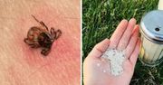 Naturalny sposób na kleszcze w ogrodzie. Wystarczy rozsypać go po roślinach i jest święty spokój