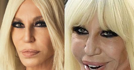 Donatella Versace zaprezentowała nowe usta. JEST LEPIEJ! (FOTO)