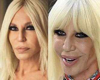 Donatella Versace zaprezentowała nowe usta. JEST LEPIEJ! (FOTO)