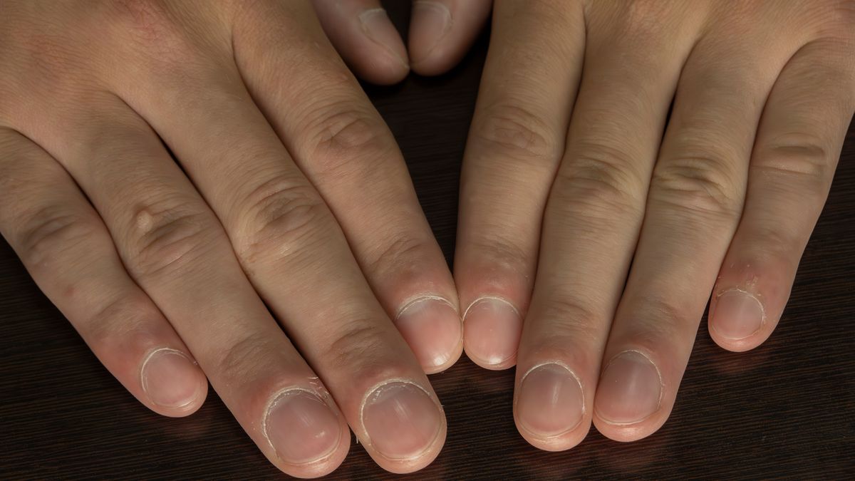 Ta choroba płuc długo nie daje jednoznacznych sygnałów