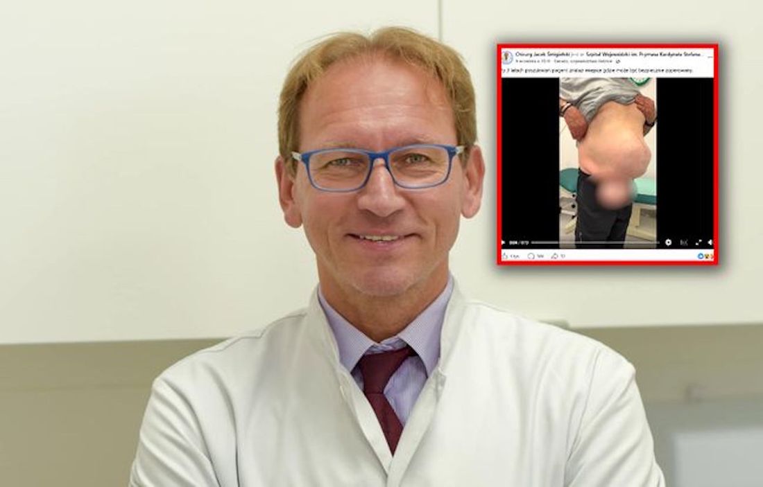 Operuje pacjentów z przepuklinami. "Latami wstydzą się rozebrać"