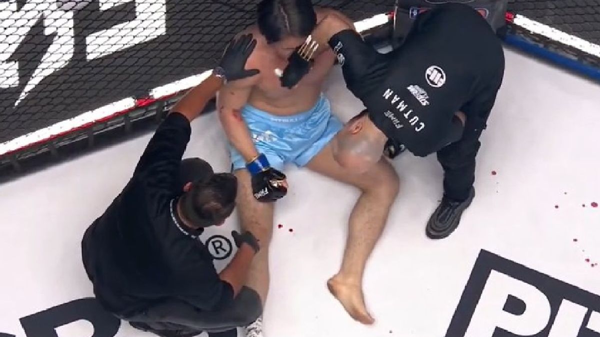 Kontuzja Natana Marconia