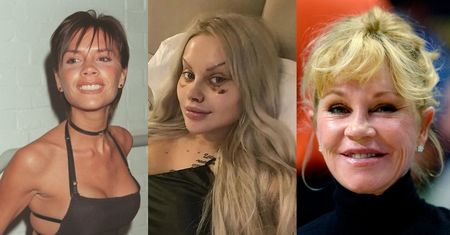 One pożałowały operacji plastycznych: Ewel0na cudem uniknęła śmierci, a Linda Evangelista została oszpecona (ZDJĘCIA)
