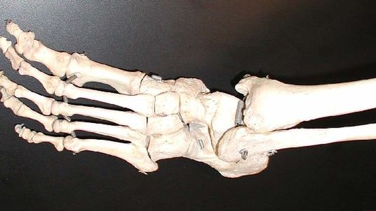 Kompozyt, który może zastąpić kość 1