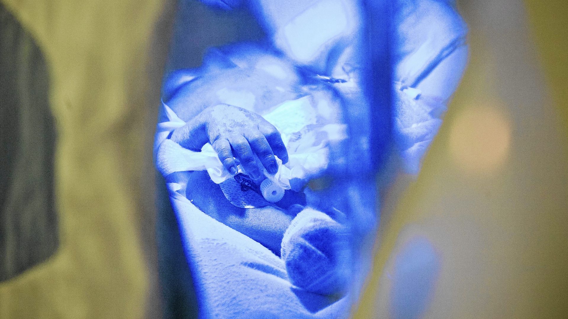 Mały pacjent w klinice neonatologii i intensywnej terapii noworodka w Uniwersyteckim Szpitalu Klinicznym w Białymstoku (zdjęcie ilustracyjne) 