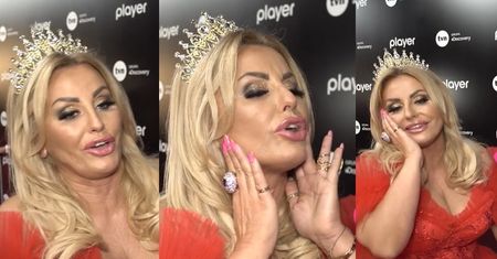 Dagmara Kaźmierska planuje LIFTING TWARZY: "Nie rozumiem, co jest takiego w starzeniu się Z GODNOŚCIĄ"