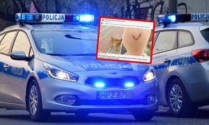 Atak psa. Poszkodowani ojciec i syn. Dramatyczny incydent