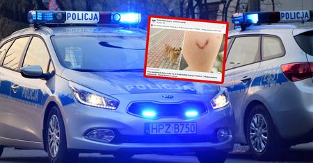 Atak psa. Poszkodowani ojciec i syn. Dramatyczny incydent