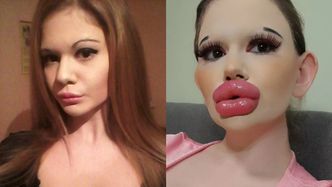 "Bułgarska Barbie" przeszła szokującą metamorfozę. Twierdzi, że ma NAJWIĘKSZE USTA na świecie! (FOTO)