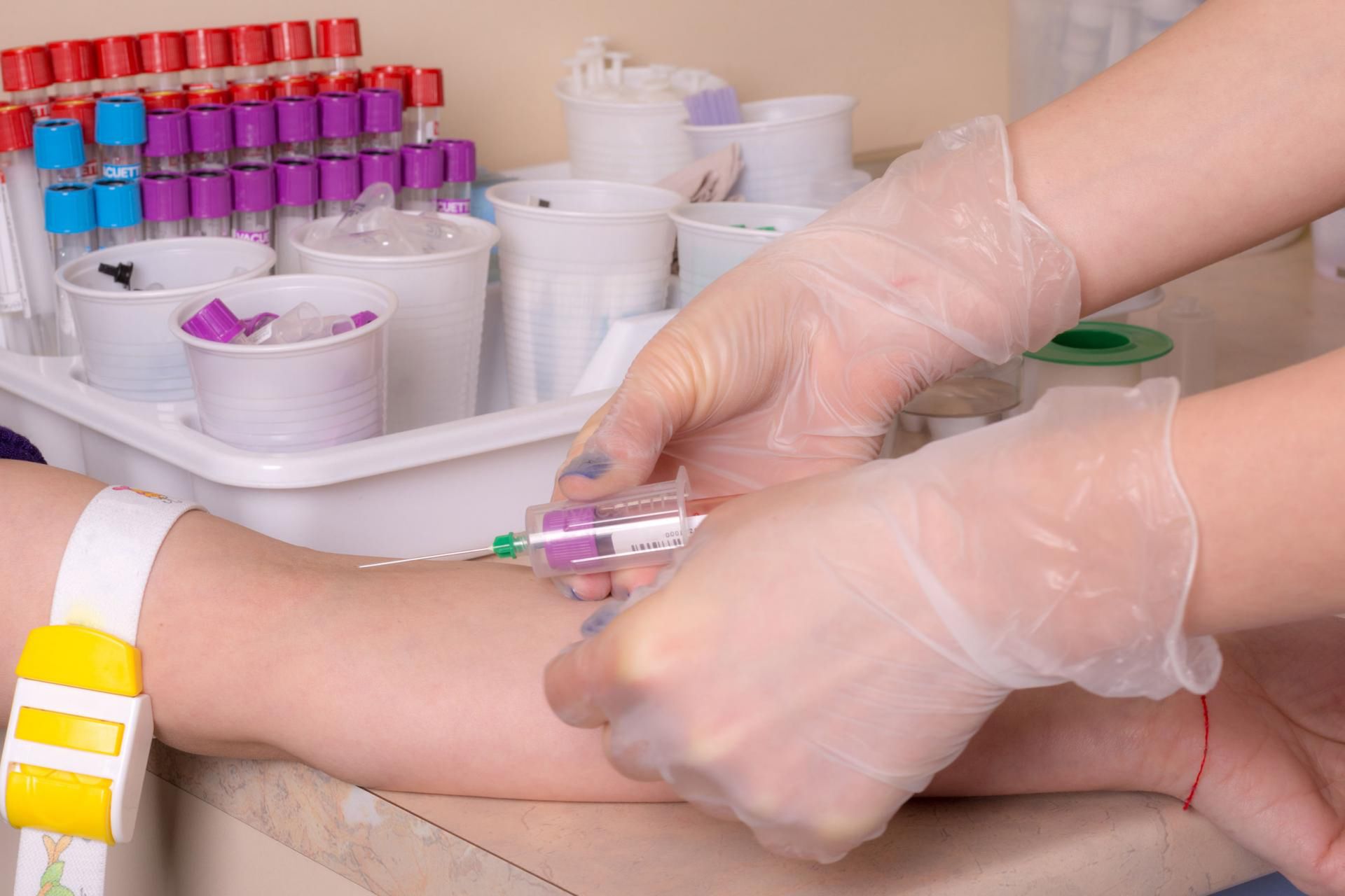 Badanie ALT to specjalistyczne badanie krwi wykonywane w diagnostyce chorób wątroby