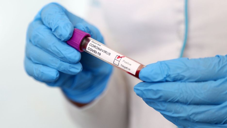 Wirusolożka prognozuje: przejście SARS-CoV-2 w kierunku wirusa sezonowego potrwa w Polsce około 10 lat