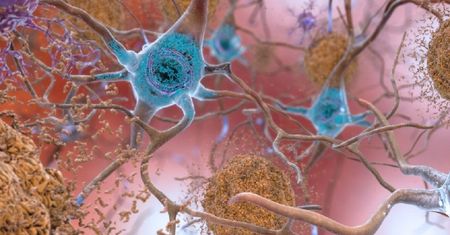 Odkrycie naukowców. Możliwy przełom w badaniach nad chorobą Alzheimera