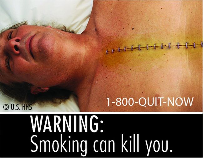 UWAGA: Palenie może Cię zabić.