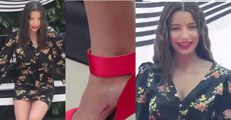 Julia Wieniawa ze skaleczoną stopą uśmiecha się do paparazzi