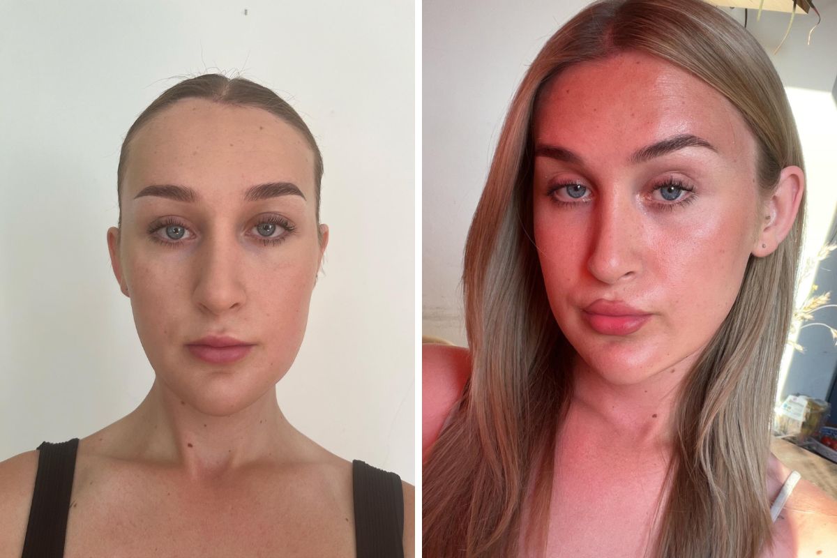 &quot;Z męskiej twarzy z silnie zaznaczoną żuchwą, mało widoczną kością jarzmową, małymi oczami musimy zrobić kobiecą twarz – ponad 90 proc. tego typu zabiegów to zabiegi feminizacji&quot;