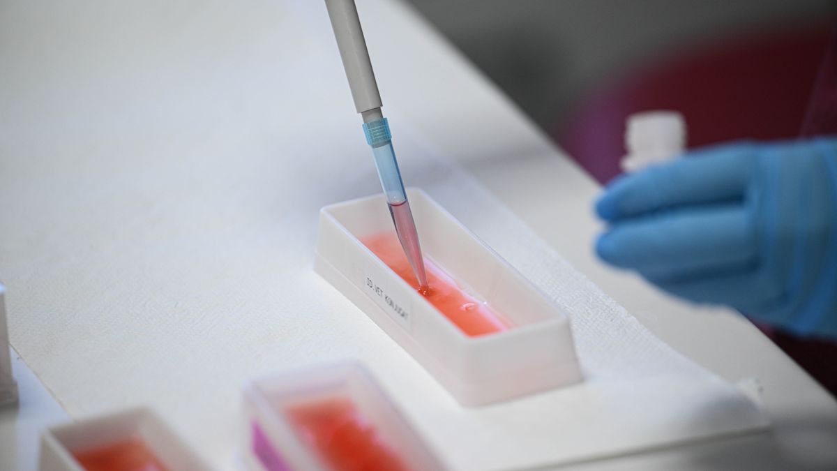 ANKARA, TURKIYE - SEPTEMBER 11: Turkiye's Foot-and-Mouth Institute under the Ministry of Agriculture and Forestry prepare 13.5 million doses of vaccine against the new SAT-1 serotype of foot-and-mouth disease to dispatch in Turkiye on September 11, 2025. (Photo by Harun Ozalp/Anadolu via Getty Images)