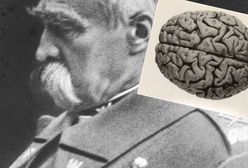 Po śmierci Józefa Piłsudskiego jego mózg odesłano do szpitala psychiatrycznego. Dlaczego?
