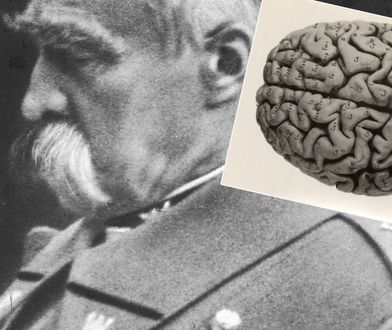 Po śmierci Józefa Piłsudskiego jego mózg odesłano do szpitala psychiatrycznego. Dlaczego?