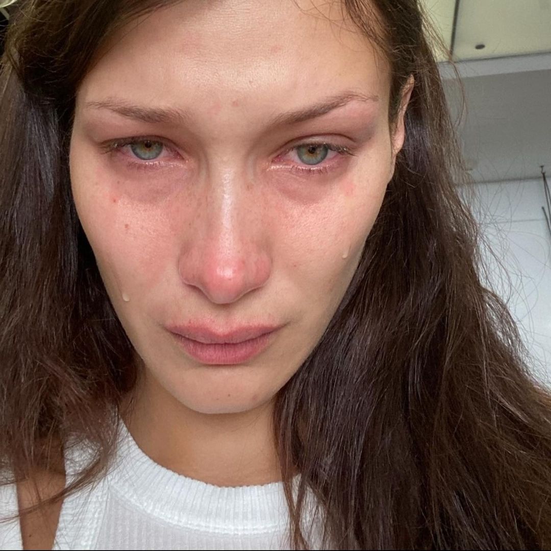 Bella Hadid o zdrowiu psychicznym