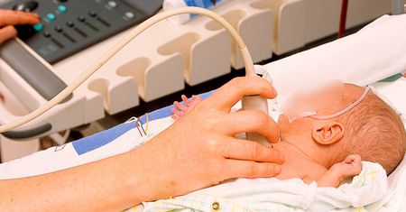 W brzuchu noworodka lekarz odkrył coś przerażającego. To zdarza się raz na milion