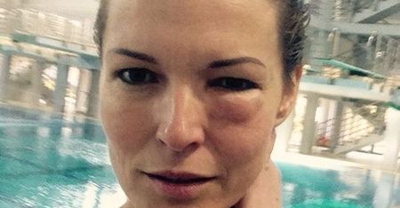 "Celebrity Splash": Ilona Felicjańska pierwszą ofiarą skoków do wody