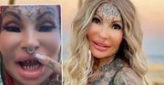 Adrianna Eisenbach kazała spiłować sobie zęby. To jej sposób na piękny wygląd